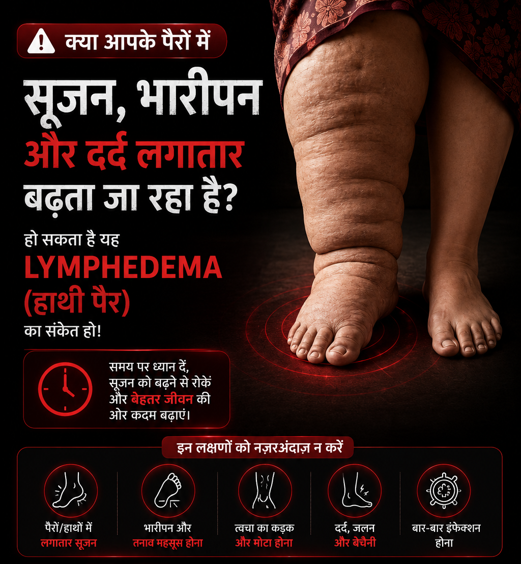 LymphoVeda